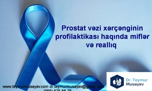 prostat sisleri xercengi